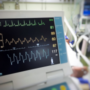 ECG monitor