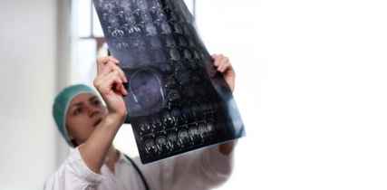 iStock 667354924 mri