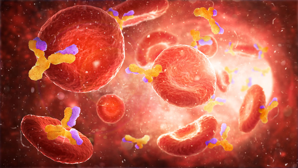 The EUROLINE Myositis Profil 3 (IgG) Line Blot was used for antibody evaluation